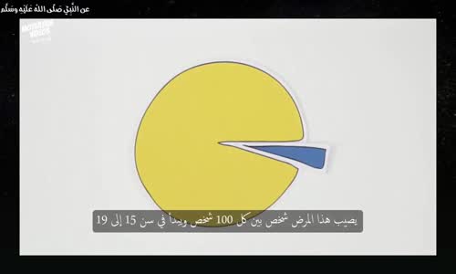 ‫ما هو مرض اضطراب العاطفة الثنائي القطب -الانفصام الشخصي (مترجم)‬‎