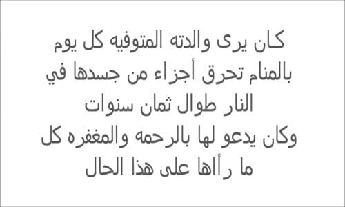 إمرأة تتعذب ٨ سنوات بالنار بسبب كأس الحليب